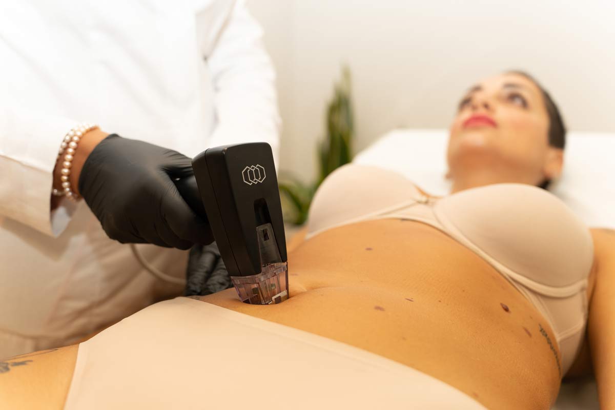 trattamento morpheus 8, medico estetico